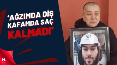 Tek Çocuğunu Kazada Kaybeden Acılı Anne: ‘Ağzımda Diş, Kafamda Saç Kalmadı’