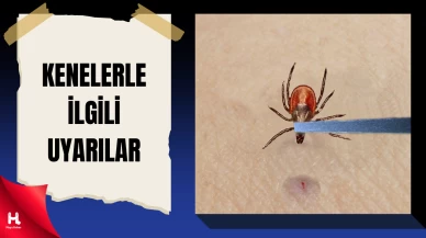 Uzmanından 'keneyi tırnaklarınız ile ezmeyin' uyarısı